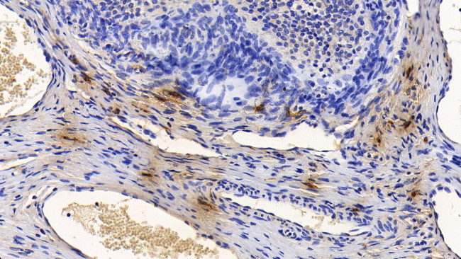 Tryptase Antibody in Immunohistochemistry (Paraffin) (IHC (P))