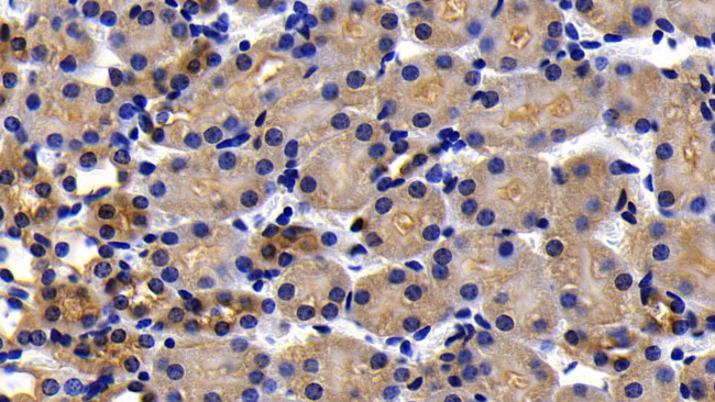 APAF1 Antibody in Immunohistochemistry (Paraffin) (IHC (P))