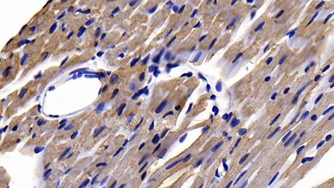 APAF1 Antibody in Immunohistochemistry (Paraffin) (IHC (P))