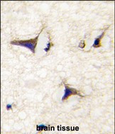 DAAM2 Antibody in Immunohistochemistry (Paraffin) (IHC (P))