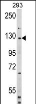 DAAM2 Antibody in Western Blot (WB)