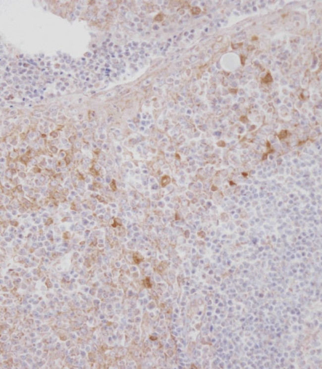 CSF1R Antibody in Immunohistochemistry (Paraffin) (IHC (P))