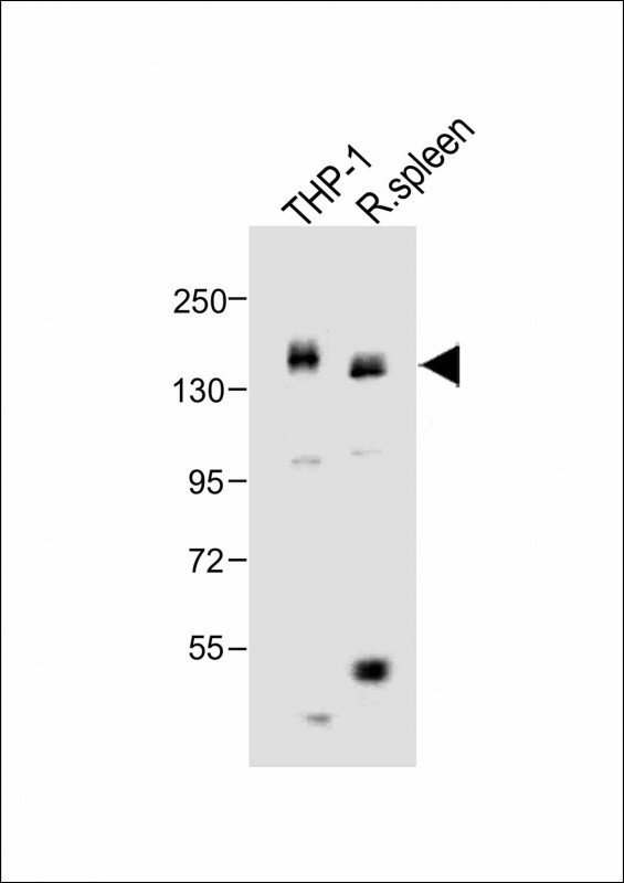 CSF1R Antibody in Western Blot (WB)