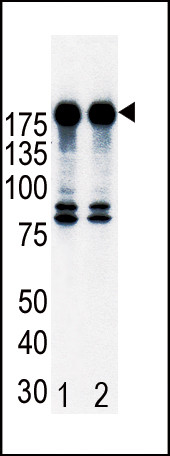 ErbB2 (HER-2) Antibody in Western Blot (WB)