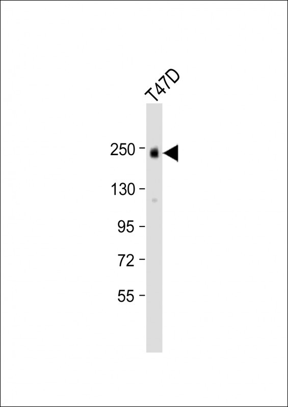 ErbB2 (HER-2) Antibody in Western Blot (WB)