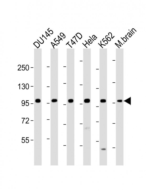 FGFR2 Antibody in Western Blot (WB)