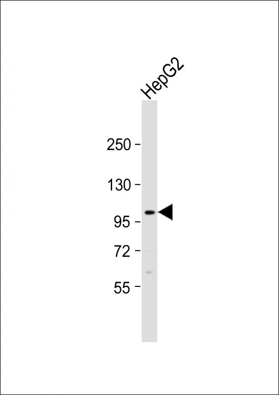 FGFR4 Antibody in Western Blot (WB)