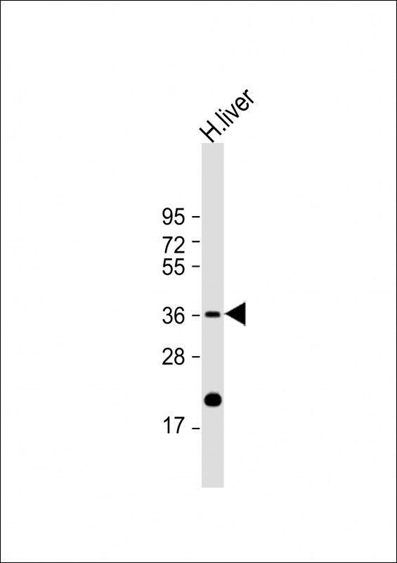 IGFBP3 Antibody in Western Blot (WB)