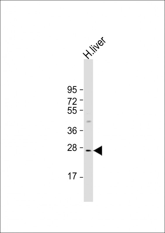 IGFBP3 Antibody in Western Blot (WB)