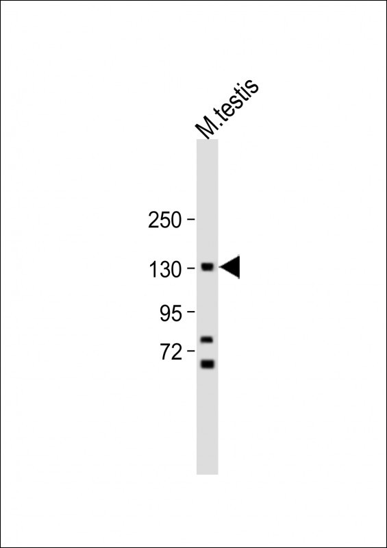 FLT3 Antibody in Western Blot (WB)