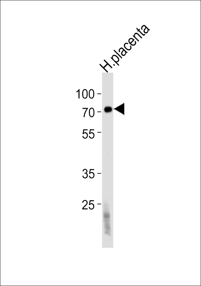 FUCA2 Antibody in Western Blot (WB)