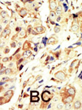 IGF1R alpha Antibody in Immunohistochemistry (Paraffin) (IHC (P))