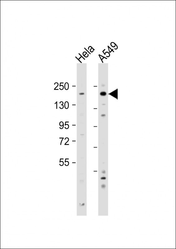 IGF1R alpha Antibody in Western Blot (WB)