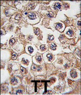 INSRR Antibody in Immunohistochemistry (Paraffin) (IHC (P))