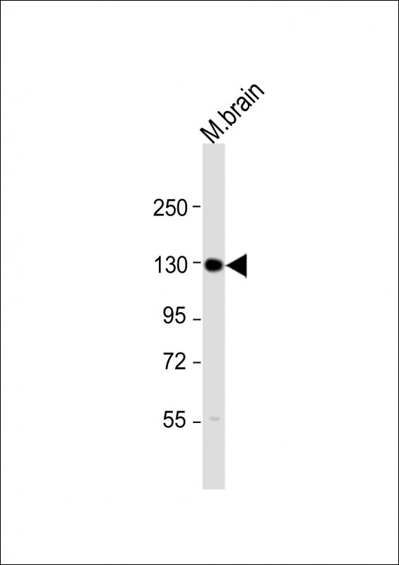 INSRR Antibody in Western Blot (WB)