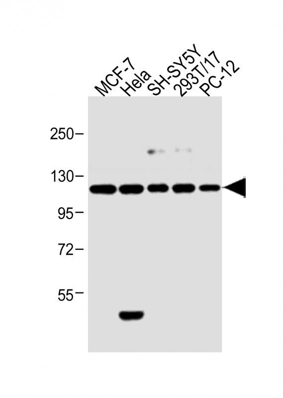 INSRR Antibody in Western Blot (WB)