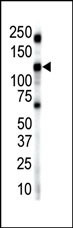 INSRR Antibody in Western Blot (WB)