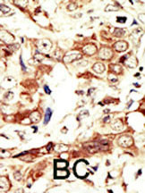 INSRR Antibody in Immunohistochemistry (Paraffin) (IHC (P))