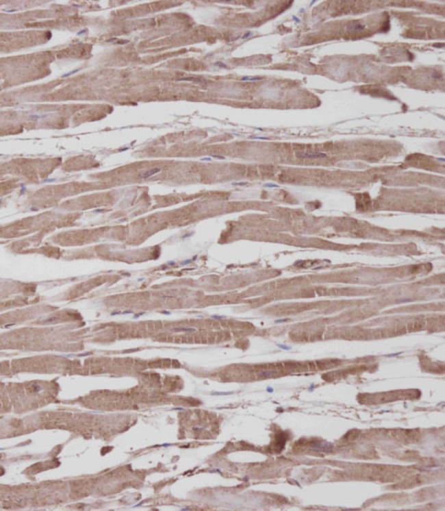 ROR1 Antibody in Immunohistochemistry (Paraffin) (IHC (P))