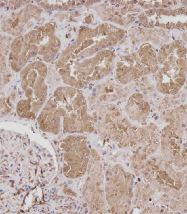 ROR1 Antibody in Immunohistochemistry (Paraffin) (IHC (P))