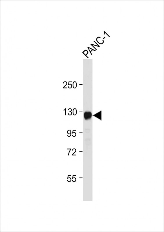 ROR1 Antibody in Western Blot (WB)