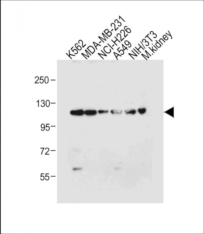 ROR1 Antibody in Western Blot (WB)