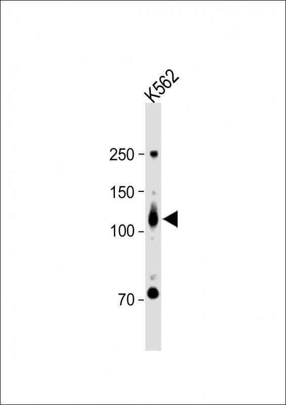 ROR2 Antibody in Western Blot (WB)