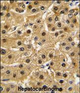 c-Abl Antibody in Immunohistochemistry (Paraffin) (IHC (P))