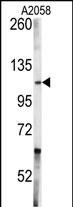 c-Abl Antibody in Western Blot (WB)