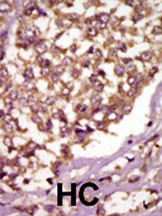 ETK Antibody in Immunohistochemistry (Paraffin) (IHC (P))