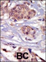 Fyn Antibody in Immunohistochemistry (Paraffin) (IHC (P))