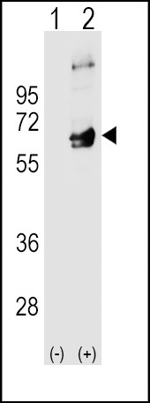 Fyn Antibody in Western Blot (WB)