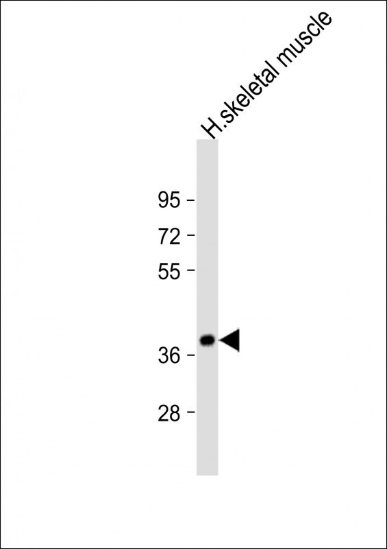 TRIB1 Antibody in Western Blot (WB)