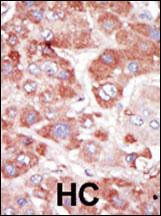 GRK7 Antibody in Immunohistochemistry (Paraffin) (IHC (P))