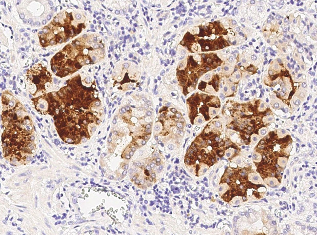 Cryptic Antibody in Immunohistochemistry (Paraffin) (IHC (P))