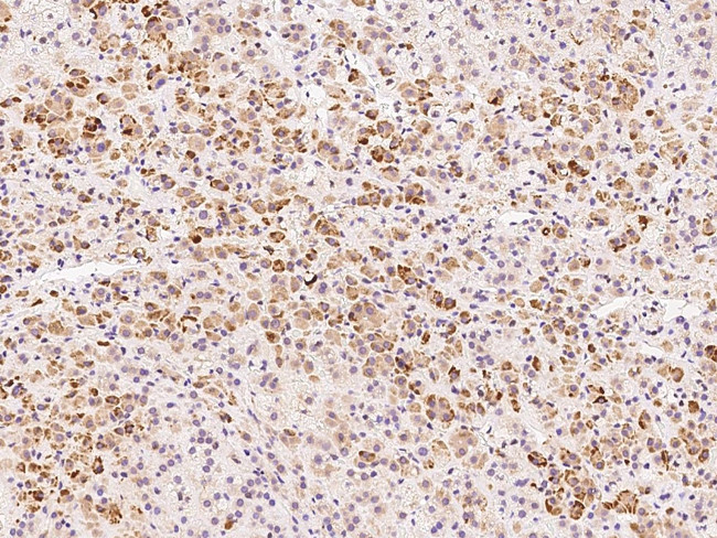 ADAT3 Antibody in Immunohistochemistry (Paraffin) (IHC (P))