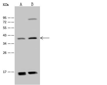 ADAT3 Antibody in Western Blot (WB)