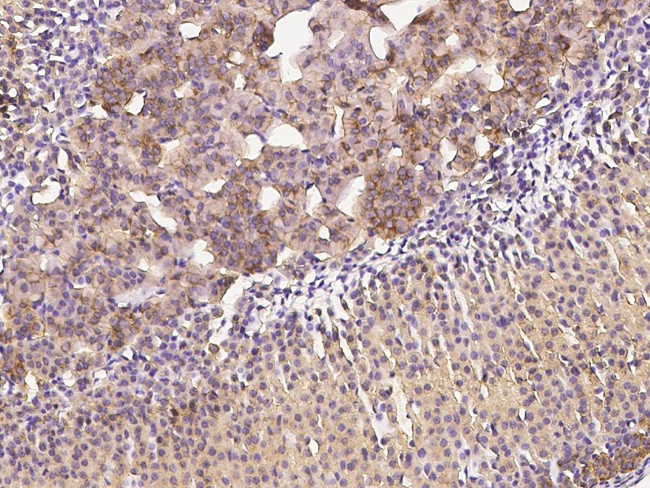 Clathrin Heavy Chain Antibody in Immunohistochemistry (Paraffin) (IHC (P))