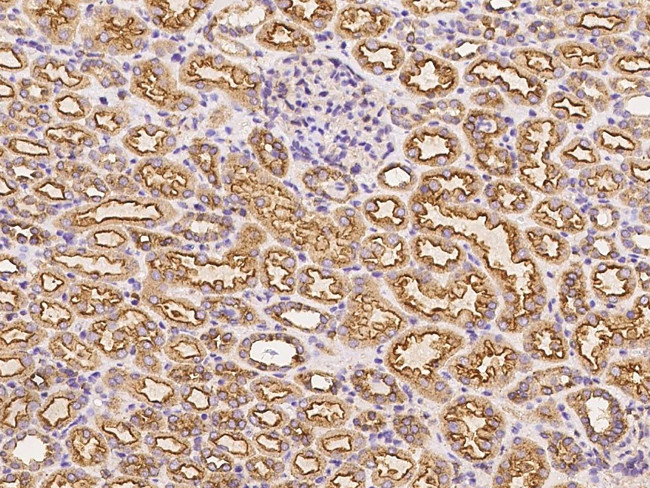 Clathrin Heavy Chain Antibody in Immunohistochemistry (Paraffin) (IHC (P))