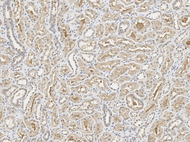 NUDT5 Antibody in Immunohistochemistry (Paraffin) (IHC (P))