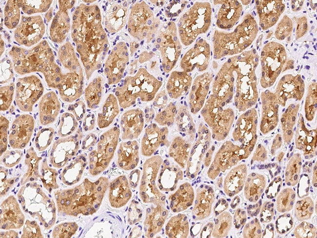 NUDT5 Antibody in Immunohistochemistry (Paraffin) (IHC (P))