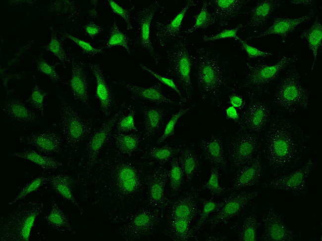 Fe65 Antibody in Immunocytochemistry (ICC/IF)