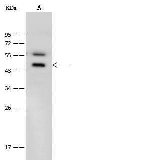 B1 Bradykinin Receptor Antibody in Western Blot (WB)