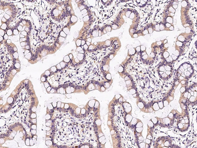 TXNL1 Antibody in Immunohistochemistry (Paraffin) (IHC (P))