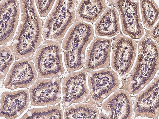 TXNL1 Antibody in Immunohistochemistry (Paraffin) (IHC (P))