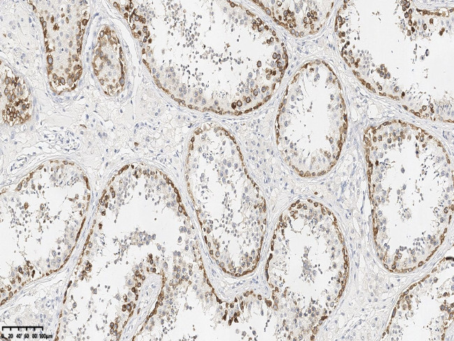 ZO-2 Antibody in Immunohistochemistry (Paraffin) (IHC (P))