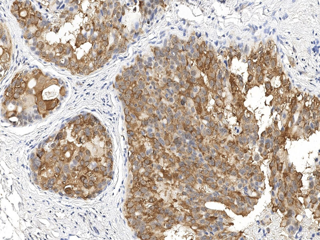 SKP2 Antibody in Immunohistochemistry (Paraffin) (IHC (P))