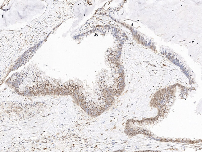 UBE2A Antibody in Immunohistochemistry (Paraffin) (IHC (P))