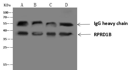 RPRD1B Antibody in Immunoprecipitation (IP)