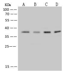 RPRD1B Antibody in Western Blot (WB)